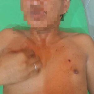 Polisi Buru Pelaku Penikaman di Plampang, Korban Ditikam Tanpa Sebab yang Jelas
