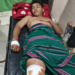 AKSI KEJAR-KEJARAN ANTAR PEMUDA DI DOMPU, DUA PELAJAR LUKA-LUKA